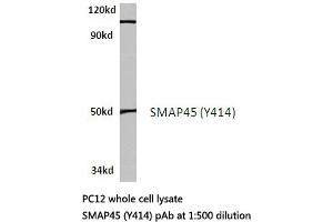 Western blot (WB) analysis of SMAP45 antibody in extracts from PC12 cells. (HDAC3 抗体)