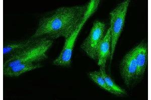 IF analysis of Filamin B/FLNB using anti-Filamin B/FLNB antibody (ABIN7601607). (FLNB 抗体  (AA 397-701))
