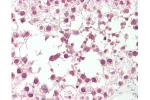 Anti-RANBP2 / TRP1 antibody IHC staining of human testis. (RANBP2 抗体  (AA 1050-1100))