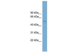 BBS4 antibody used at 1 ug/ml to detect target protein. (BBS4 抗体  (Middle Region))