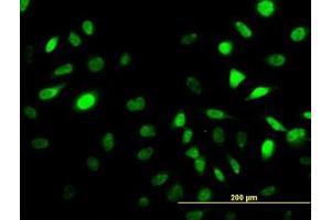 Image no. 1 for anti-Sestrin 2 (SESN2) (AA 1-481) antibody (ABIN466250) (Sestrin 2 抗体  (AA 1-481))