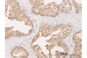 Immunoperoxidase of monoclonal antibody to DCXR on formalin-fixed paraffin-embedded human prostate. (DCXR 抗体  (AA 145-244))