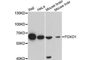 Western blot analysis of extracts of various cell lines, using FOXO1 antibody. (FOXO1 抗体)