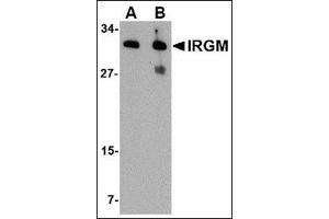 Western blot analysis of IRGM in human brain lysate with this product at (A) 1 and (B) 2 μg/ml. (IRGM 抗体  (Center))