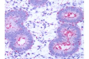 Immunohistochemistry (IHC) image for anti-G Protein-Coupled Receptor 50 (GPR50) (C-Term) antibody (ABIN1049059)