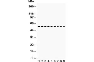 Western blot testing of Vimentin antibody and Lane 1:  HT1080;  2: NIH3T3;  3: Jurkat;  4: HUT;  5: MCF-7;  6: HeLa;  7: human placenta;  8: rat testis;  9: mouse testis lysate (Vimentin 抗体  (C-Term))