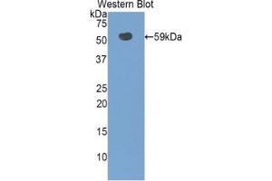 Western blot analysis of the recombinant protein. (SLC3A2 抗体  (AA 282-523))