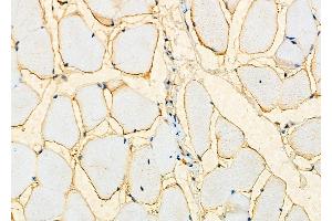 ABIN6259906 and ABIN6276534 at 1/100 staining Mouse muscle tissue by IHC-P. (AMACR 抗体  (Internal Region))
