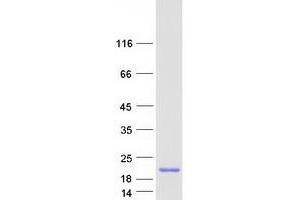 Western Blotting (WB) image for Limb-Bud and Heart (LBH) protein (Myc-DYKDDDDK Tag) (ABIN2724728)