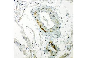 Anti-Caveolin-2 antibody, IHC(P) IHC(P): Rat Cardiac Muscle Tissue (Caveolin 2 抗体  (N-Term))