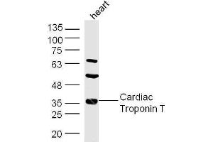Mouse heart lysates probed with Rabbit Anti-Troponin T Polyclonal Antibody, Unconjugated  at 1:500 for 90 min at 37˚C. (Troponin T 抗体  (AA 201-298))