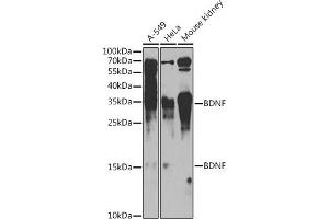Western blot analysis of extracts of various cell lines, using BDNF antibody (ABIN6129991, ABIN6137522, ABIN6137524 and ABIN6215043) at 1:1000 dilution. (BDNF 抗体  (AA 20-247))