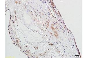 Formalin-fixed and paraffin embedded rat aorta tissue labeled with Anti-PPAR Gamma Polyclonal Antibody, Unconjugated (ABIN1386283) at 1:300 followed by conjugation to the secondary antibody (PPARG 抗体  (AA 315-420))