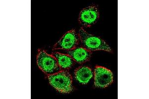 Confocal immunofluorescent analysis of TYSY Antibody (C-term) (ABIN1882144 and ABIN2840937) with Hela cell followed by Alexa Fluor 488-conjugated goat anti-rabbit lgG (green). (TYMS 抗体  (C-Term))