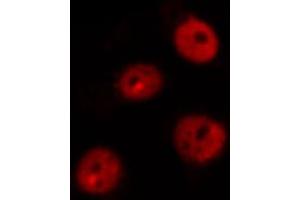 ABIN6269101 staining MOLT by IF/ICC. (Retinoblastoma 1 抗体  (C-Term))