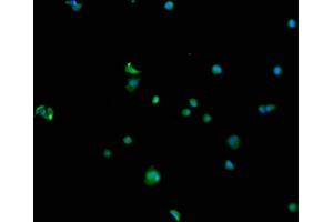 Immunofluorescence staining of MCF-7 cells with ABIN7168807 at 1:100, counter-stained with DAPI. (SEMA4F 抗体  (AA 417-659))