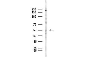 Western blot analysis of lysates from HepG2 cells(LPS,4h treatment), using EIF2 Antibody at 1/1000 dilution.