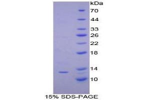 SDS-PAGE analysis of Dog IP10 Protein. (CXCL10 蛋白)