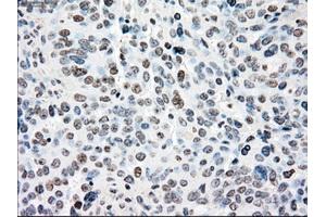 Immunohistochemical staining of paraffin-embedded colon tissue using anti-NRBP1mouse monoclonal antibody. (NRBP1 抗体)
