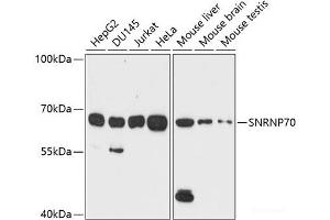 Western blot analysis of extracts of various cell lines using SNRNP70 Polyclonal Antibody at dilution of 1:1000. (SNRNP70 抗体)