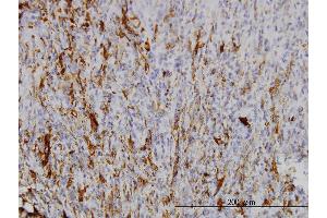 Immunostaining (ISt) image for anti-Secretagogin, EF-Hand Calcium Binding Protein (SCGN) (AA 1-276) antibody (ABIN564621)