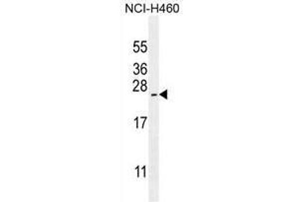 ARL17A Antikörper  (Middle Region)