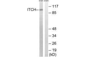Western blot analysis of extracts from mouse brain cells, using ITCH (Ab-420) antibody. (ITCH 抗体  (Tyr420))