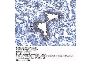Rabbit Anti-KIF5A antibody   Paraffin Embedded Tissue: Human Lung cell Cellular Data: bronchiole epithelium of renal tubule Antibody Concentration: 4. (KIF5A 抗体  (Middle Region))