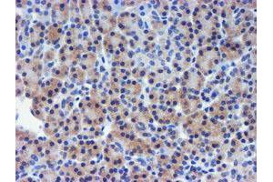 Image no. 2 for anti-Metalloproteinase Inhibitor 2 (TIMP2) antibody (ABIN1501394) (TIMP2 抗体)