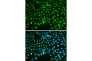 Immunofluorescence analysis of HeLa cells using DLG antibody (ABIN6130274, ABIN6139656, ABIN6139657 and ABIN6217626). (DLGAP5 抗体  (AA 547-846))