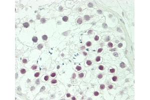 Formalin-fixed and paraffin-embedded H. (CBX8 抗体  (AA 197-230))