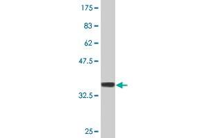 Western Blot detection against Immunogen (37. (FN3K 抗体  (AA 61-170))