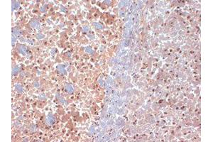SAP97 Immunohistochemistry. (DLG1 抗体  (N-Term))