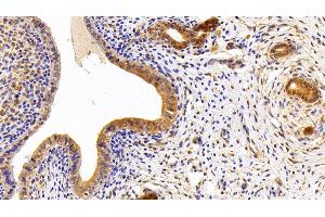 Detection of LPIN1 in Rat Uterus Tissue using Polyclonal Antibody to Lipin 1 (LPIN1) (Lipin 1 抗体  (AA 729-924))