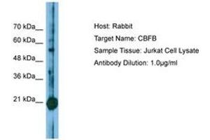 Image no. 1 for anti-Core-Binding Factor, beta Subunit (CBFB) (N-Term) antibody (ABIN6749810) (CBFB 抗体  (N-Term))