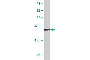 Western Blot detection against Immunogen (45. (DYDC2 抗体  (AA 1-177))