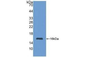 Detection of Recombinant MT1, Human using Polyclonal Antibody to Metallothionein 1 (MT1) (MT1 抗体  (AA 1-61))