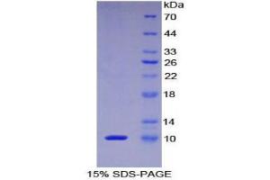SDS-PAGE (SDS) image for Protein Kinase (CAMP-Dependent, Catalytic) Inhibitor alpha (PKIA) (AA 13-71) protein (His tag) (ABIN1877235)