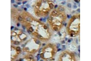 Used in DAB staining on fromalin fixed paraffin-embedded Kidney tissue (SNCG 抗体  (AA 1-115))