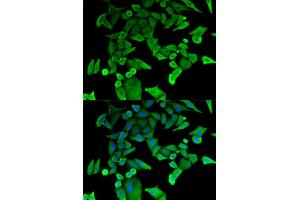 Immunofluorescence analysis of HeLa cells using TPT1 antibody. (TPT1 抗体)