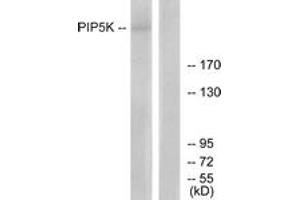 Western Blotting (WB) image for anti-phosphoinositide Kinase, FYVE Finger Containing (PIKFYVE) (AA 71-120) antibody (ABIN2889821) (PIKFYVE 抗体  (AA 71-120))