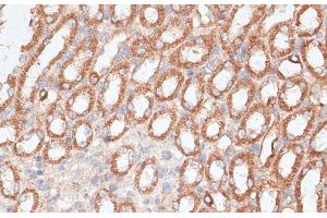 Immunohistochemistry (Paraffin-embedded Sections) (IHC (p)) image for anti-Kinesin Family Member 4A (KIF4A) antibody (ABIN7255191)
