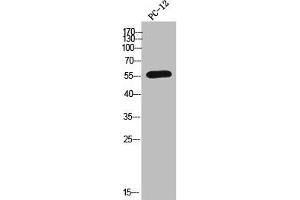 Western Blotting (WB) image for anti-Cytochrome P450, Family 2, Subfamily A, Polypeptide 6 (CYP2A6) (N-Term) antibody (ABIN7188680)