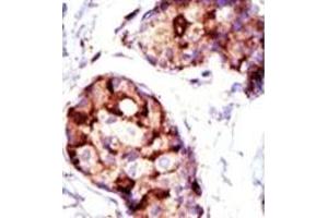 Image no. 2 for anti-Tumor Susceptibility Gene 101 (TSG101) (N-Term) antibody (ABIN357572)