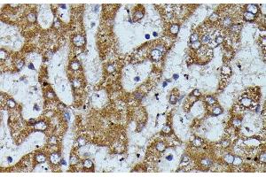 Immunohistochemistry of paraffin-embedded Human liver using APOC3 Polyclonal Antibody at dilution of 1:100 (40x lens).