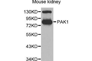 Western blot analysis of extracts of mouse kidney, using PAK1 antibody. (PAK1 抗体)