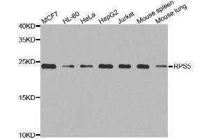 Western blot analysis of extracts of various cell lines, using RPS5 antibody. (RPS5 抗体)