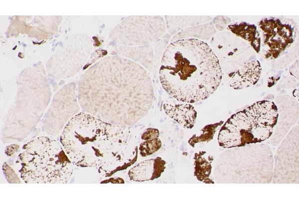 Myotilin 抗体  (C-Term)