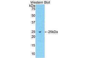 Western Blotting (WB) image for anti-Fibronectin (AA 355-558) antibody (ABIN1078037) (Fibronectin 抗体  (AA 355-558))