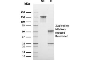 SDS-PAGE Analysis Purified C1QB Mouse Monoclonal Antibody (C1QB/2965). (C1QB 抗体  (AA 41-188))